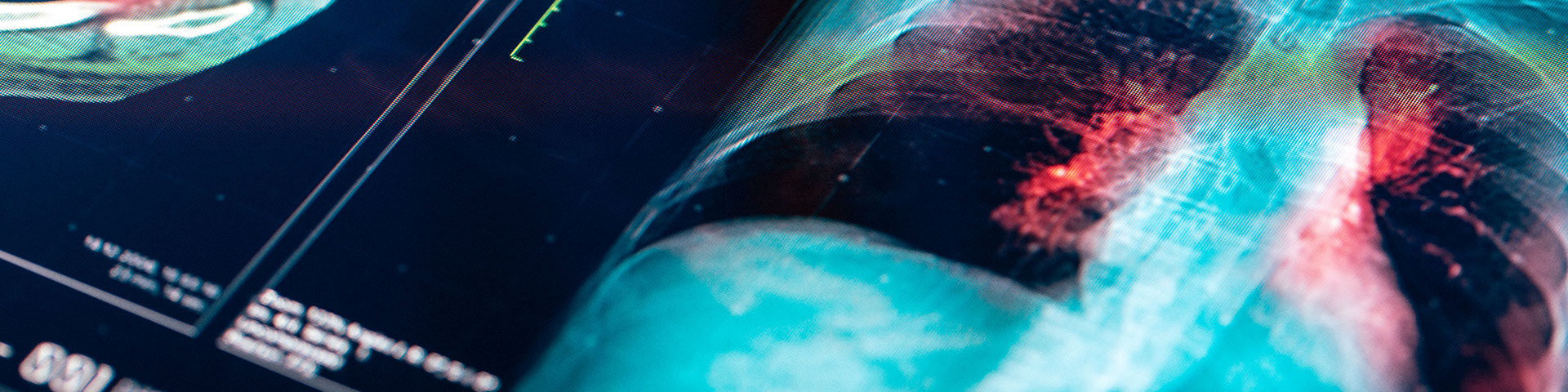 Imagen destacada Tecnología e Innovación en el sector salud