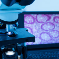 ZOE TECNOLOGIA REDDI